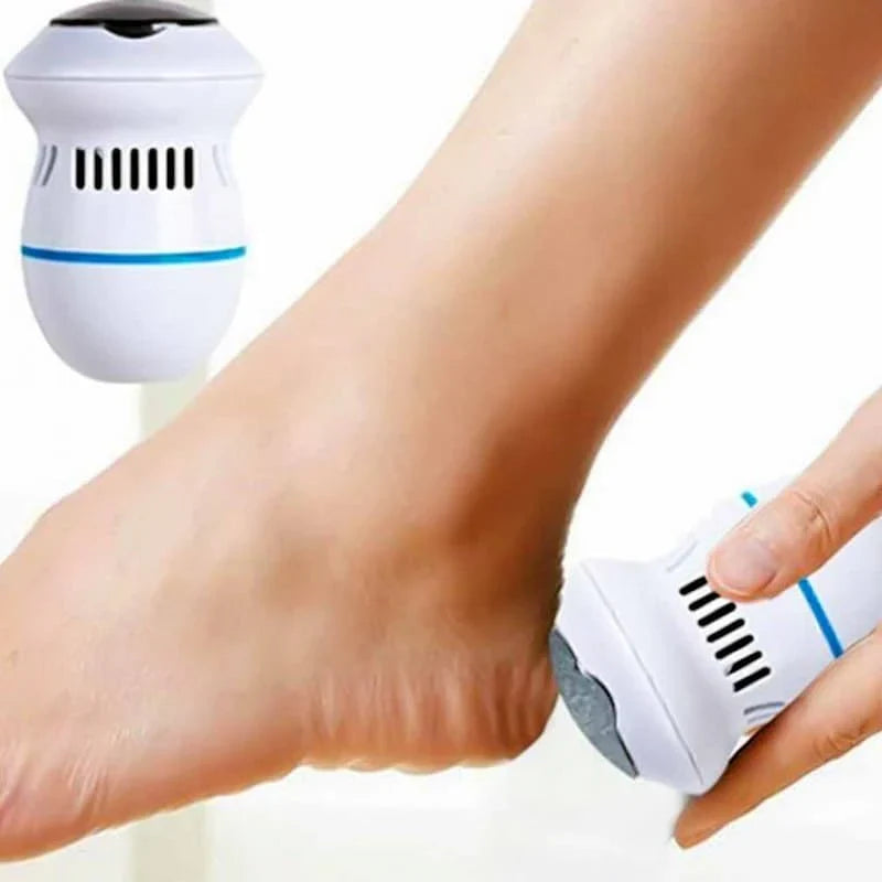 Electric Callus Remover
